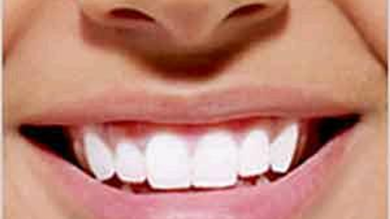 Diş eti hastalıklarında erken tedavi önemli