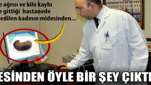 Midesinden öyle birşey çıktı ki...