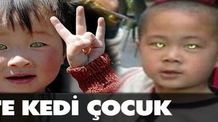 Kedi çocuk Nong