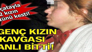 Kızların kavgası kanlı bitti!..