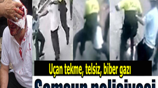 AK Partili Meclis üyesine polis dayağı