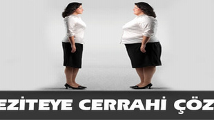 Obeziteye cerrahi çözüm