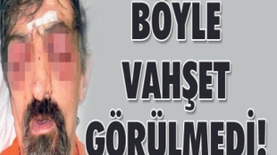 Böyle vahşet görülmedi!