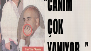 CANIM ÇOK YANIYOR