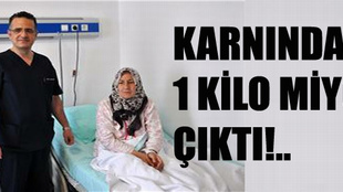 Karnından 1 kilo miyom çıktı