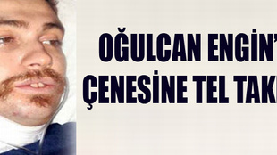 Oğulcan Engin'in çenesine tel takıldı