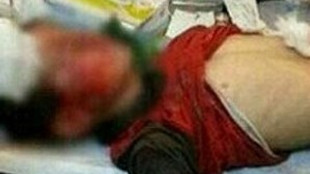 10 yaşındaki Mehmet Ezer başından yaralandı