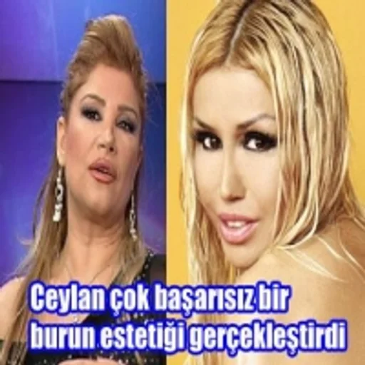 Burun Estetigi Cok Kotu Sacitaslan Com