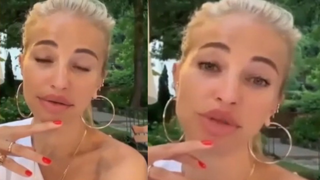 Sosyal medya Burcu Esmersoy'un dudaklarını konuşuyor!
