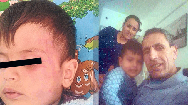 Mahkeme küçük çocuğa ‘darp’ı görmedi!