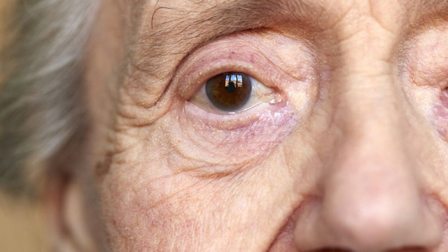 Alzheimera karşı günde 8 bin adım
