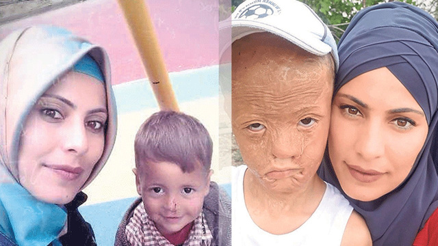 Küçük Halil'in yüzü Eylül ayında gülecek