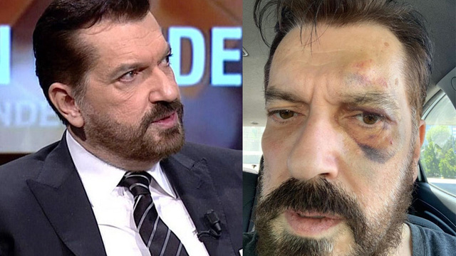 Hakan Bayrakçı feci şekilde darp edildi!