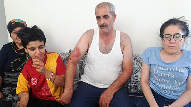 Engelli kız ve babasını bayıltana kadar dövdüler!
