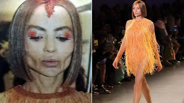 Günay Musayeva'nın yanaklarına ne oldu?