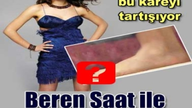 Beren Saat altı parmaklı mı?