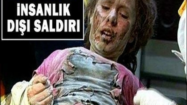 İNANILMAZ SALDIRI!..