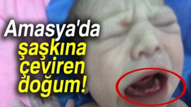 Amasya'da şaşkına çeviren doğum!