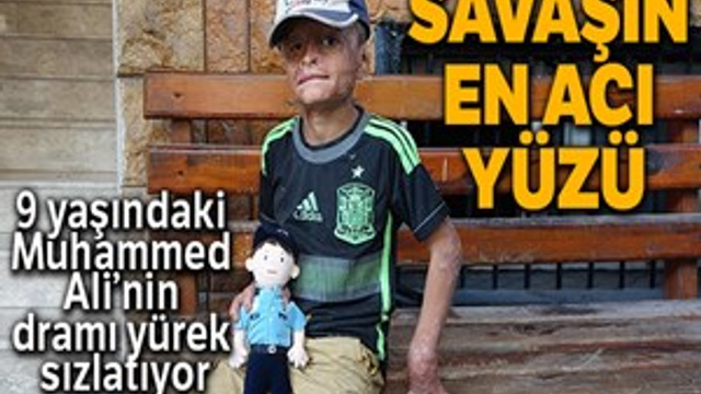 Savaşın en acı yüzü Suriyeli Muhammed