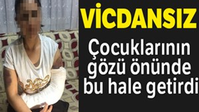 Kocası inşaat demiriyle döverek bu hale getirdi!