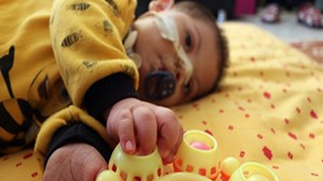 Minik Efe sağlığına kavuşacağı günü bekliyor