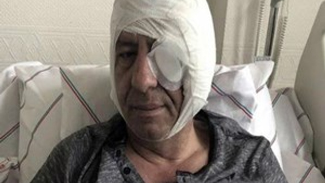 Yeniçağ yazarından saldırı sonrası ilk yazı