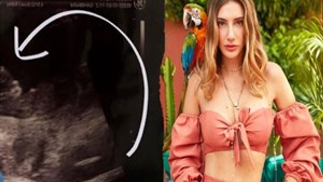 Ultrason fotoğrafını paylaşan Şeyma Subaşı şaşırttı!