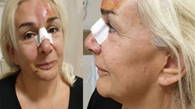 Burçin Orhon'a ne oldu?..