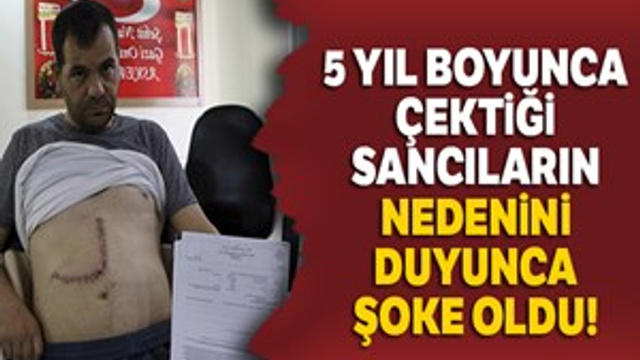 Karnında 5 yıl boyunca gazlı bez ile yaşadı