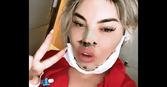 Jessica Alves Ameliyat Olmak Icin Turkiye Ye Geldi Sacitaslan Com
